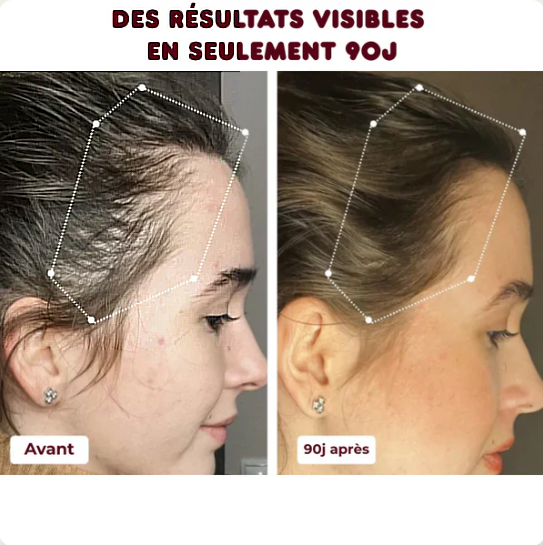 Masseur de cuir chevelu électrique